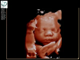 Upload ultrasound images